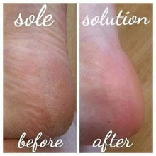 SALE | Sole Solution Foot Cream