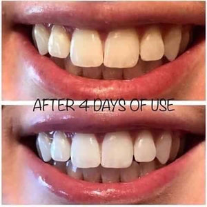 AP24 whitening toothpaste 2 pack Special