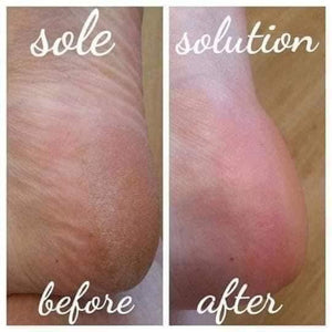 SALE | Sole Solution Foot Cream