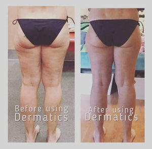 Dermatic Effects - Anti-Cellulite Treatment - Buy 1 Get 1 Sale